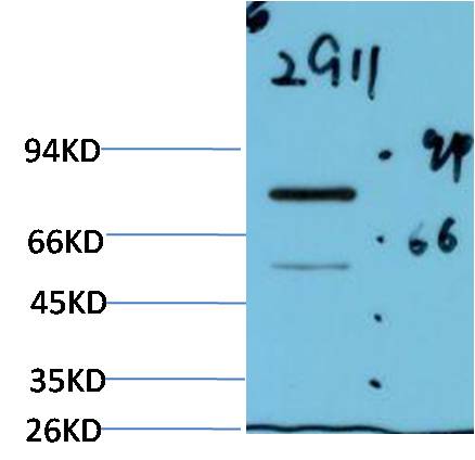 Western blot analysis of Firefly LuciferaseTransfected Hela Cell Lysate using Luciferase (EM1305) Mouse mAb diluted at 1:2000.
