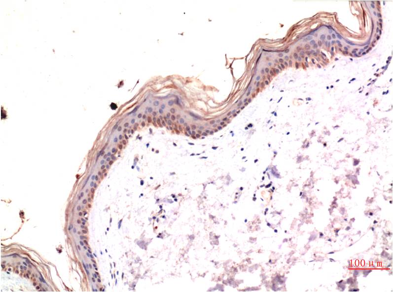 Immunohistochemical analysis of paraffin-embedded Human Skin Tissue using Phospho-MLKL S358 (EM1320) Mouse mAb diluted at 1:200.