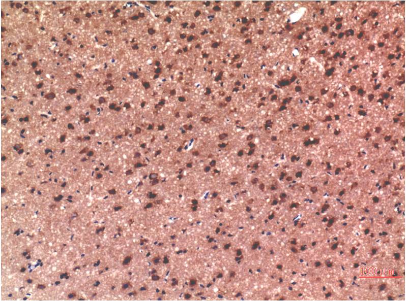 Immunohistochemical analysis of paraffin-embedded Rat Brain Tissue using Tau ( EM1321) Mouse mAb diluted at 1:200.