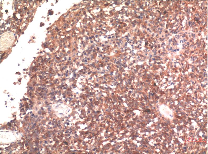 Immunohistochemical analysis of paraffin-embedded Human Brain Tissue using Tau ( EM1321) Mouse mAb diluted at 1:200.