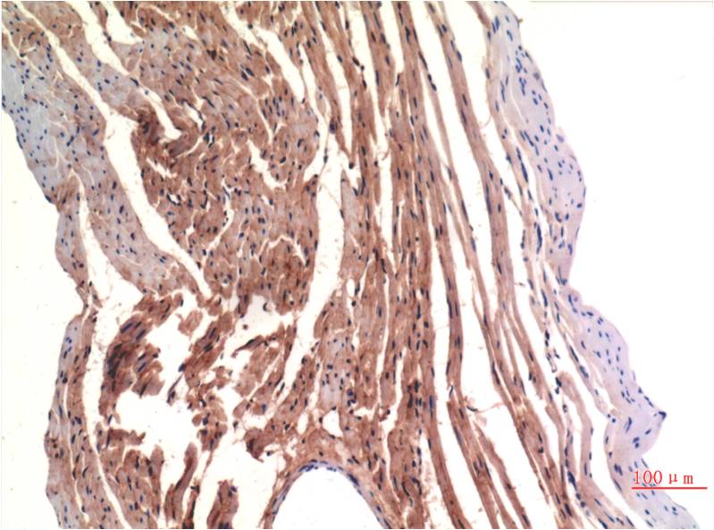 Immunohistochemical analysis of paraffin-embedded Rat Heart Tissue using VE-Cadherin (EM1322) Mouse mAb diluted at 1:200.
