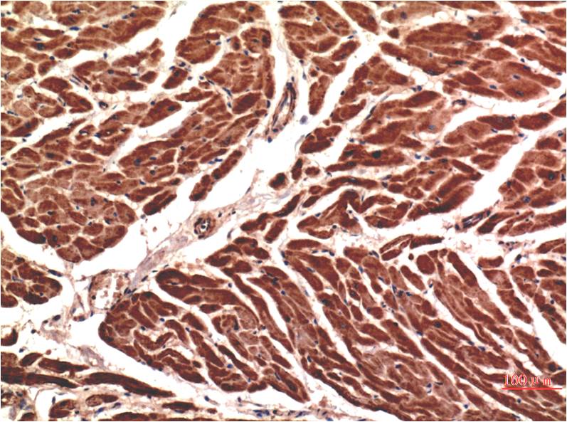 Immunohistochemical analysis of paraffin-embedded Human Heart Tissue using VE-Cadherin ( EM1322 ) Mouse mAb diluted at 1:200.