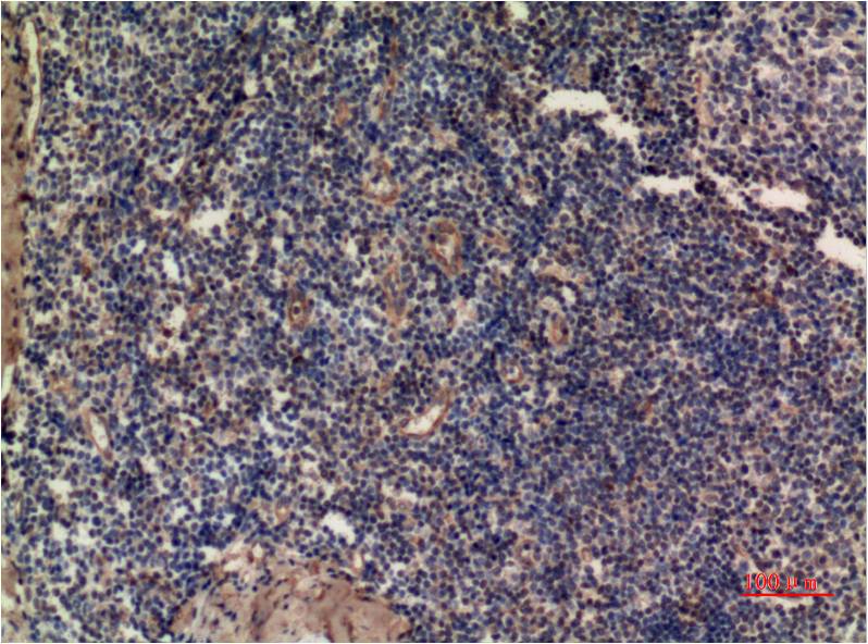 Immunohistochemical analysis of paraffin-embedded Human Tonsil Tissue using ERK1 (EM1323) Mouse mAb diluted at 1:200.