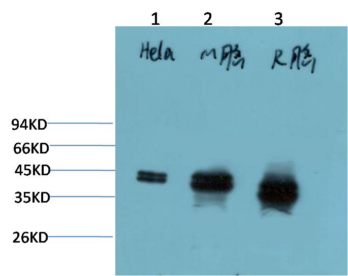 Western blot analysis of 1) Hela Cell Lysate, 2)Mouse Brain Tissue Lysate, 3) Rat Brain Tissue Lysate using ERK1/2 (EM1326) Mouse mAb diluted at 1:2000.