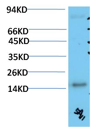 Western blot analysis of Human Serum using TTR (EM1356) Mouse mAb diluted at 1:2000.