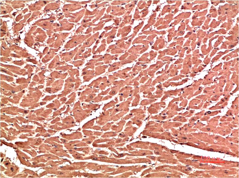Immunohistochemical analysis of paraffin-embedded Human Heart Tissue using VE-Cadherin (EM1384) Mouse mAb diluted at 1:200.