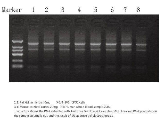 TRIpure Total RNA Extraction Reagent