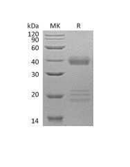 Recombinant Human IGFBP-5 (C-6His)