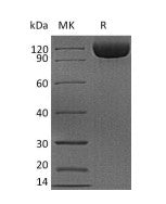 Recombinant Human CD26 (C-6His)