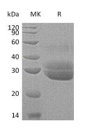 Recombinant Human EPDR1 (C-6His)