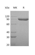 Recombinant Human ITIH3 (C-6His)