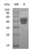 Recombinant Mouse M-CSF (C-6His)