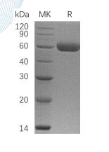 Recombinant Human OPG (C-6His)