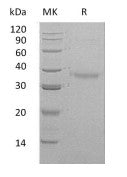 Recombinant Human CRHBP (C-6His)