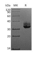 Recombinant Human CD207 (N-6His)
