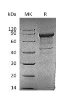 Recombinant Human TFRC (N-6His)