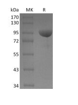 Recombinant Human EphB1 (C-Fc)