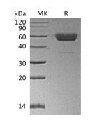 Recombinant Human/Mouse/Rat Irisin (C-Fc)