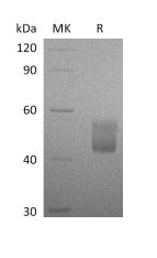 Recombinant Human CFHR3 (C-6His)