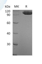Recombinant Human EphA2 (C-Fc)