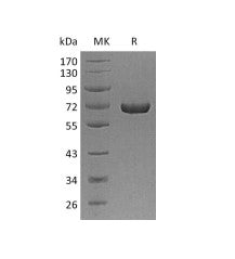 Recombinant Human AFP (C-6His)