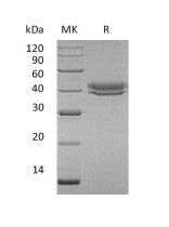 Recombinant Human CFHR1 (C-6His)