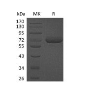 Recombinant Human CFHR5 (C-6His)