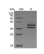 Recombinant Human CFHR2 (C-6His)