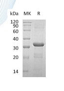 Recombinant Human CORO6 (N-6His)