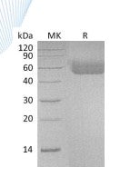 Recombinant Human IL-1R1 (C-6His)