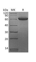 Recombinant Human EPO-R (C-Fc)