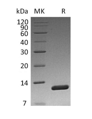 Recombinant Vibriocholerae Toxin B