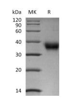 Biotinylated Human FOLR1 (C-6His-Avi)