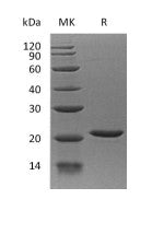 Recombinant Human EIF1AX (N-6His)
