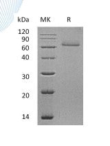Recombinant Human CDSN (C-6His)