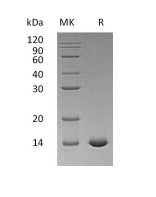 Recombinant Human IL-2 (aldesleukin)