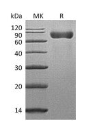 Recombinant Mouse SLAMF3 (C-6His)