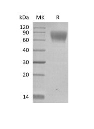 Biotinylated Human 5T4 (C-Avi-6His)