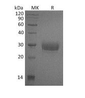 Recombinant Human CD32a (H167,C-6His)