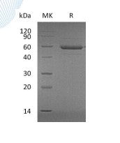 Recombinant Human APRIL (N-Flag-His)