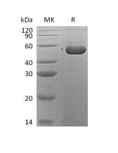 Recombinant Human Serpin B12 (C-6His)