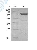 Recombinant Human EpCAM (C-Fc)
