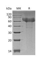 Recombinant Human TIM-4 (C-6His)