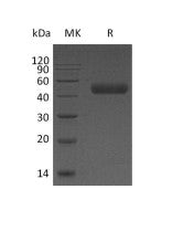 Recombinant Human Galectin 9 (C-6His)