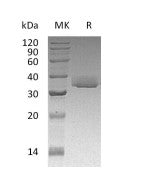Recombinant Human LGALS3 (C-6His)