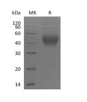 Recombinant Mouse SLAMF2 (C-6His)