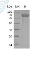 Recombinant Mouse PLXDC2 (C-6His)