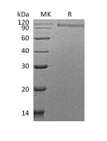 Recombinant Human HER2 (C-6His)