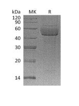 Recombinant Human SDC1 (C-6His)