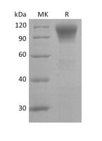 Recombinant Human CD45R0 (C-6His)